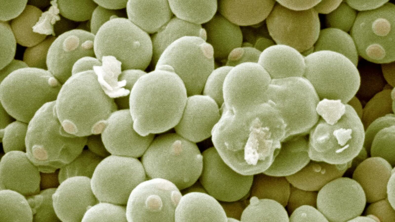 Saccharomyces Cerevisiae Microscope Saccharomyces Cerevisiae Microscope