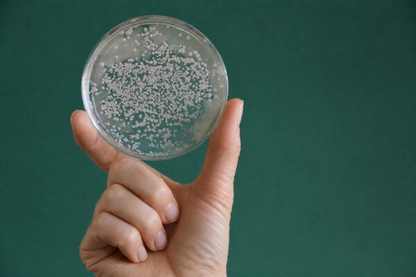 What are the most commonly used yeast strains in industrial production?